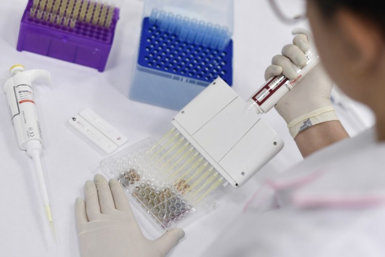 Anvisa realizara terceira fase de teste de vacina contra o corona vírus